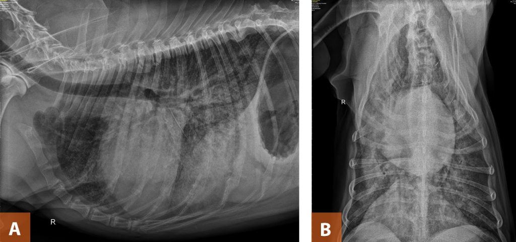 Imagen 1: Radiografía lateral (A) y dorsoventral (B) en un Doberman pinscher de 8 años con insuficiencia cardiaca congestiva. Nótese el agrandamiento del corazón con un borde caudal recto, atrio izquierdo prominente y elevación traqueal. Se observa un patron alveolar/intersticial difuso con dilatación de las venas pulmonares. (Créditos: Swift S. 2018) 